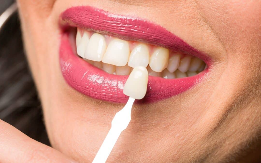 patient receiving restorative dental treatments and maintaining their oral health with tips from Bright Dental Studio in Bismarck ND